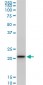 RPS5 Antibody (monoclonal) (M02)