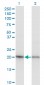RPS5 Antibody (monoclonal) (M02)