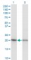 RPS5 Antibody (monoclonal) (M02)