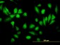 RPS5 Antibody (monoclonal) (M02)