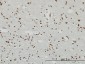 RPS6KA2 Antibody (monoclonal) (M01)