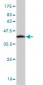 RPS6KA2 Antibody (monoclonal) (M01)