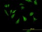 RPS6KB1 Antibody (monoclonal) (M01)