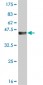 RPS6KB1 Antibody (monoclonal) (M01)