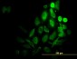 RPS6KB1 Antibody (monoclonal) (M02)