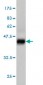 RPS6KB1 Antibody (monoclonal) (M02)