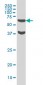 RPS6KB1 Antibody (monoclonal) (M02)