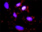 RPS6KB1 Antibody (monoclonal) (M02)