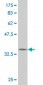 RPS6KB1 Antibody (monoclonal) (M03)