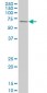 RPS6KB1 Antibody (monoclonal) (M03)