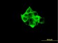 RPS6KB1 Antibody (monoclonal) (M03)