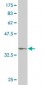 RPS6KB1 Antibody (monoclonal) (M04)