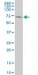 RPS6KB1 Antibody (monoclonal) (M04)