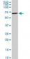 RPS6KB1 Antibody (monoclonal) (M04)