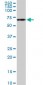 RPS6KB1 Antibody (monoclonal) (M04)