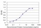 RPS6KB1 Antibody (monoclonal) (M04)