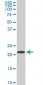 RPS7 Antibody (monoclonal) (M03)