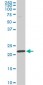 RPS7 Antibody (monoclonal) (M03)