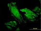 RPS7 Antibody (monoclonal) (M03)