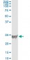 RRAS Antibody (monoclonal) (M01)