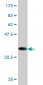 RRM1 Antibody (monoclonal) (M03)