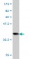 RRM1 Antibody (monoclonal) (M03)