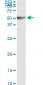 RRM2 Antibody (monoclonal) (M01)