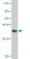 RRM2 Antibody (monoclonal) (M01)