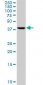 RRM2 Antibody (monoclonal) (M01)