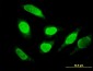 RUNDC2A Antibody (monoclonal) (M02)