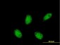 RXRA Antibody (monoclonal) (M07)