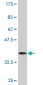 RXRB Antibody (monoclonal) (M01)