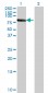 RXRB Antibody (monoclonal) (M01)