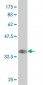 RXRG Antibody (monoclonal) (M01)