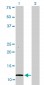 S100A1 Antibody (monoclonal) (M01)