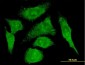 S100A10 Antibody (monoclonal) (M01)