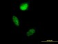 S100A4 Antibody (monoclonal) (M01)