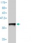 S100A4 Antibody (monoclonal) (M01)