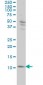 S100A4 Antibody (monoclonal) (M01)