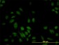 S100A6 Antibody (monoclonal) (M10)