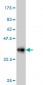 S100A6 Antibody (monoclonal) (M10)