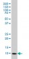 S100A6 Antibody (monoclonal) (M10)