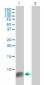 S100A6 Antibody (monoclonal) (M10)