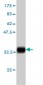 S100A6 Antibody (monoclonal) (M16)