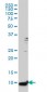 S100A6 Antibody (monoclonal) (M16)