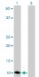 S100A6 Antibody (monoclonal) (M16)