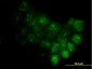 S100A7 Antibody (monoclonal) (M02)