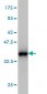 S100A8 Antibody (monoclonal) (M01)