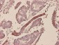 SAA1 Antibody (monoclonal) (M01)