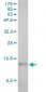 SAA1 Antibody (monoclonal) (M01)